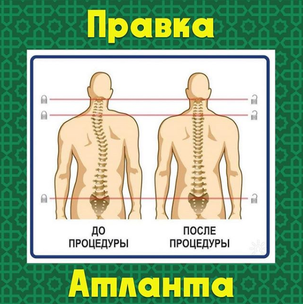 Фото Хиджама - Алматы