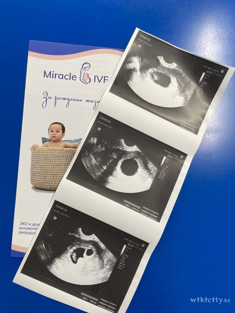 Фото Miracle IVF - Алматы. Мы гордимся своими результатами!