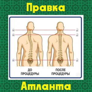 Фото Хиджама