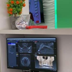 Фото PoliDent Clinic