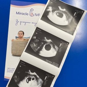 Фото Miracle IVF